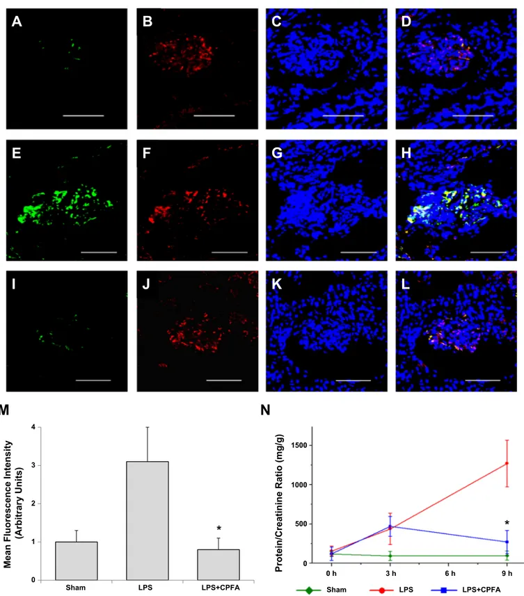 Fig. 5. Coupled plasma filtration and adsorption (CPFA) treatment reduces podocyte expression of CD80 and urinary protein excretion after LPS exposure in a pig model of acute renal damage