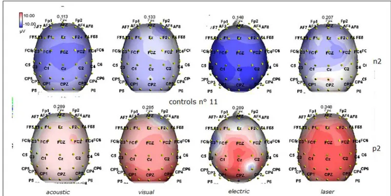 FIGURE 2 | Grand average maps of N2 and P2 amplitudes by, acoustic, visual, electric and laser stimuli in 11 controls are reported