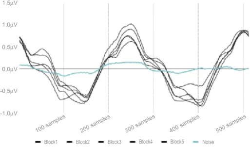 Figure 1 Five consecutive blocks of steady-state pattern electroretinogram (time domain – 512 samples).