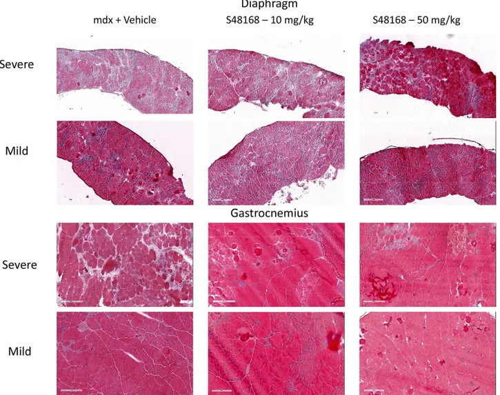 Figure 8. Representative images of H&amp;E-stained DIA and GC muscles exhibiting mild-to-severe phenotypic variations in mdx mice treated with vehicle or with S48168 at10 or 50 mg/kg per day for 12 wk