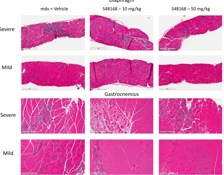 Figure 4. Representative images of H&amp;E-stained DIA and GC muscles, exhibiting mild-to-severe phenotypic variances of mdx mice treated with vehicle or with S48168 at 10 or 50 mg/kg per day after 4 wk of treatment