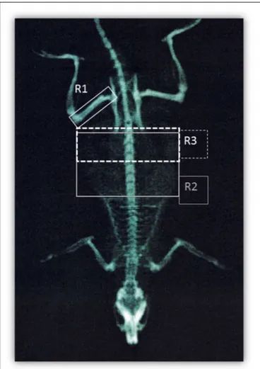 FIGURE 1 | DEXA scanning. Representation of regions of interest used for DEXA quantification: right femur (R1), T9-L5 vertebrae (R2), and L1-L6 vertebrae (R3).