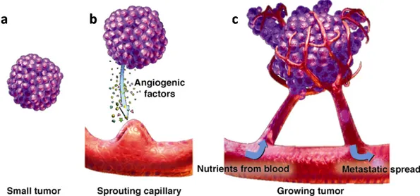 Figure 2. (a–c) Tumor expansion induced by the sprouting of blood vessels. From small tumor (a),  sprouting capillary (b) to growing tumor (c)