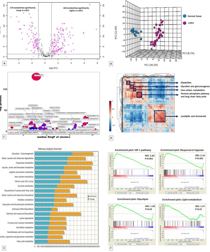Figure 1.  Volcano plot of the 516 metabolites profiled. 344 exhibited significant differential abundance when comparing ccRCC to normal kidney tissues (A). Principal component analysis (PCA) of global tissue metabolome demonstrated that the two groups (cc