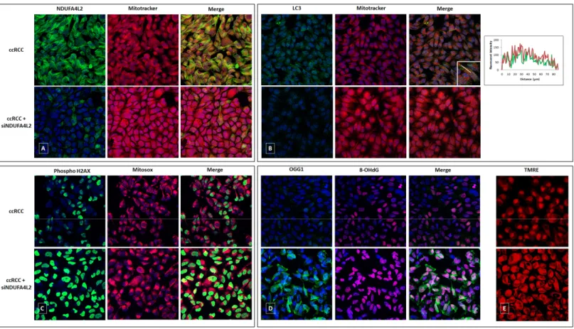 Figure  4.  Immunofluorescence  showing  the  increase  in  MitoTracker  signal  levels  in  ccRCC  cells  treated  with  small  interfering  RNA targeting  NDUFA4L2  (siNDUFA4L2)  compared  to  untreated  cells  (A).  The  autophagic  marker  LC3  is  inc