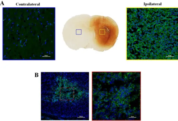 Figure 7.  The immunohistochemical staining (anti-CD68; Serotec, Oxford, UK) of the ipsilateral (left:  200x) and contralateral areas (right: 200x) in LPS-induced inflammation rat brain sections (A) and human 