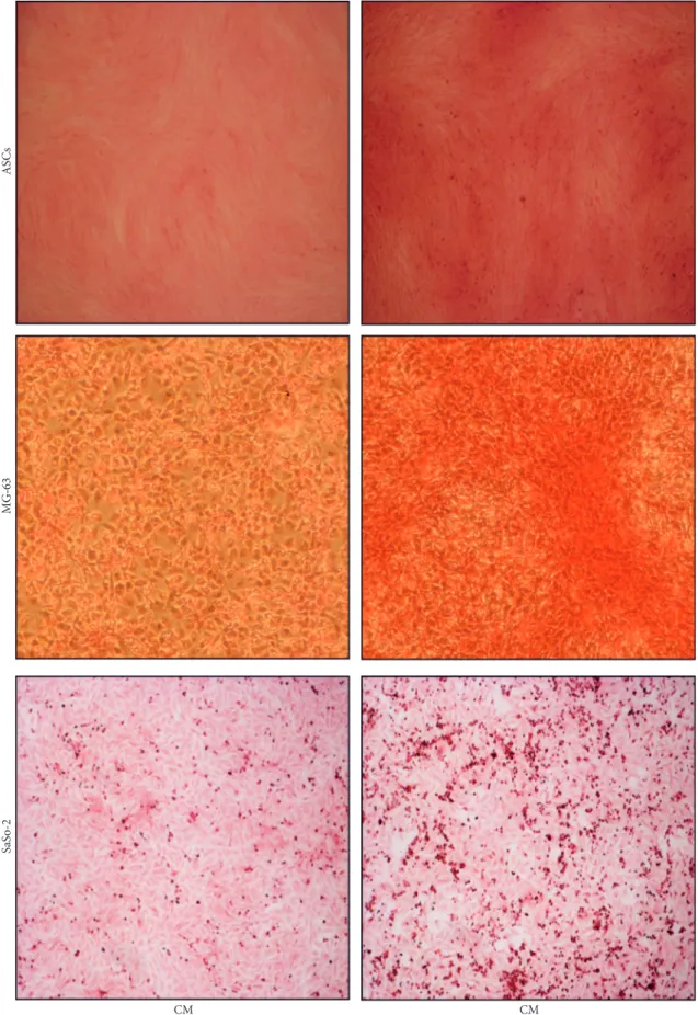 Figure 4: Collagen staining. Sirius Red dye staining was performed in order to show collagen deposition at day 3 in SaOs-2 and at day 7 in MG-63 and ASCs