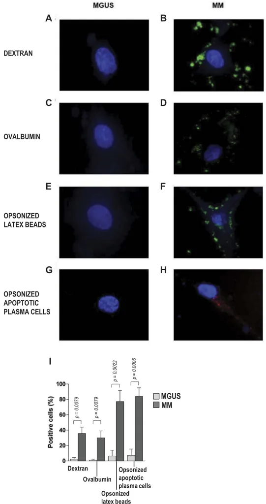 Figure 4. Phagocytosis by bone marrow EC. (A-H) Representative photomicrographs of EC from MGUS patients (left panels) and MM patients (right panels) that have engulfed, in vitro, green fluorescent dextran, green fluorescent ovalbumin, green fluorescent la