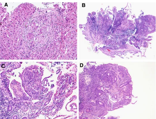 Fig. 3 The computerized tomography shows a complete resolution of the splenic lesions (a) and of the lung infiltration (b)