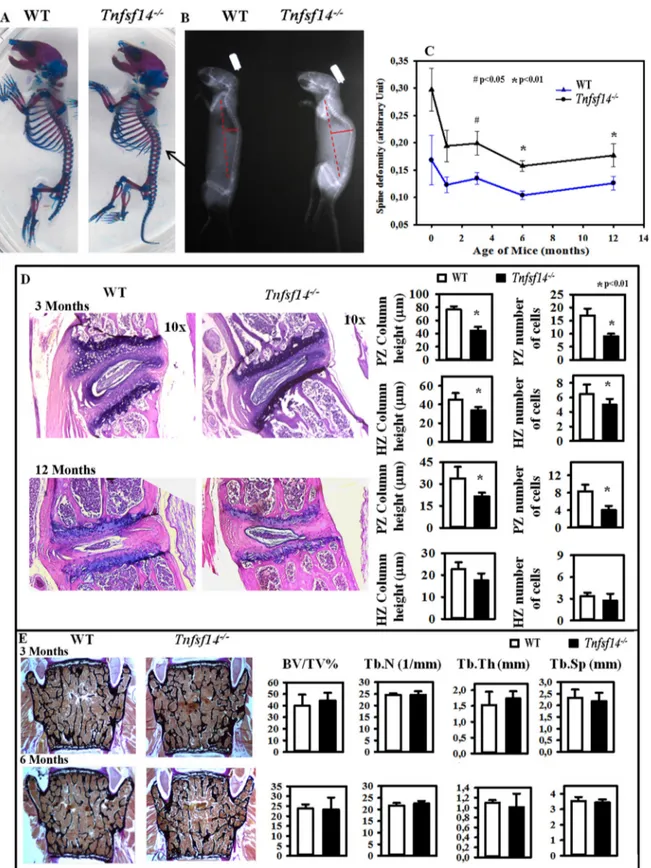 Fig. 1. Skeletal morphology and bone structure of Tnfsf14 -/- mice. Representative images of alizarin red/alcian blue staining of bone and cartilage tissues of newborn WT and Tnfsf14 -/- mice are shown (A)