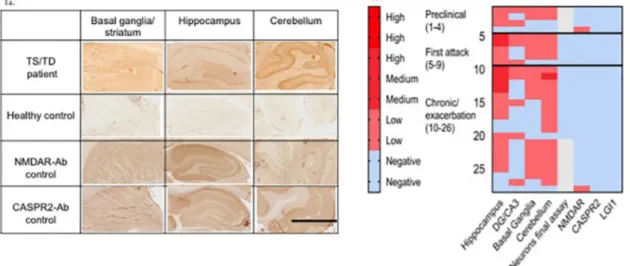 Fig. 1. Examples of immunohistology on rodent brain tissue sections. 1a. Binding of antibodies by immunohistology