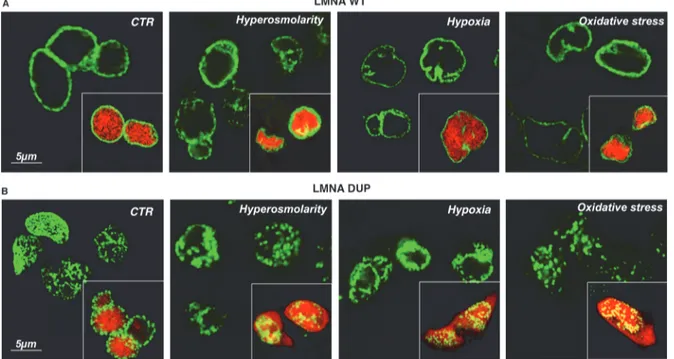 Fig 5. Analysis of nuclear envelope integrity under stressing condition in LMNA transfected HL-1 cells