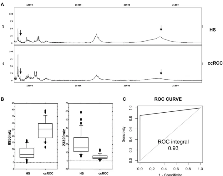 Figure 1: Recognition of ccRCC by urine protein profiling. (A) Representative urine protein profiling of one ccRCC patient  (ccRCC) and one Healthy Subject (HS); the arrows show the two mass peaks (8,956 m/z and 23,320 m/z, respectively) used for the CART 