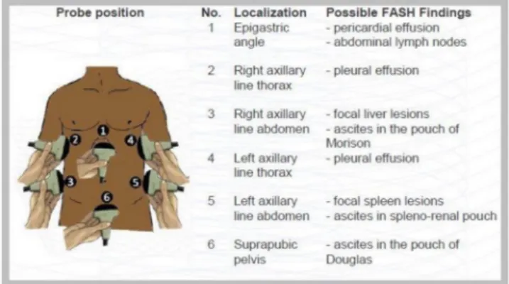 Figure 1  FASH examination protocol: probe positions  and findings (from Focus Assessment with Sonography for  HIV/TB