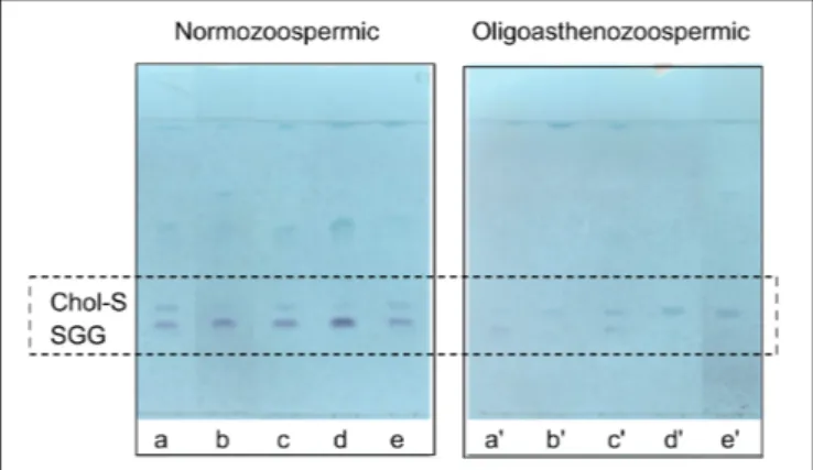 FIGURE 5 | Comparison of TLC sulfolipid profiles of semen of