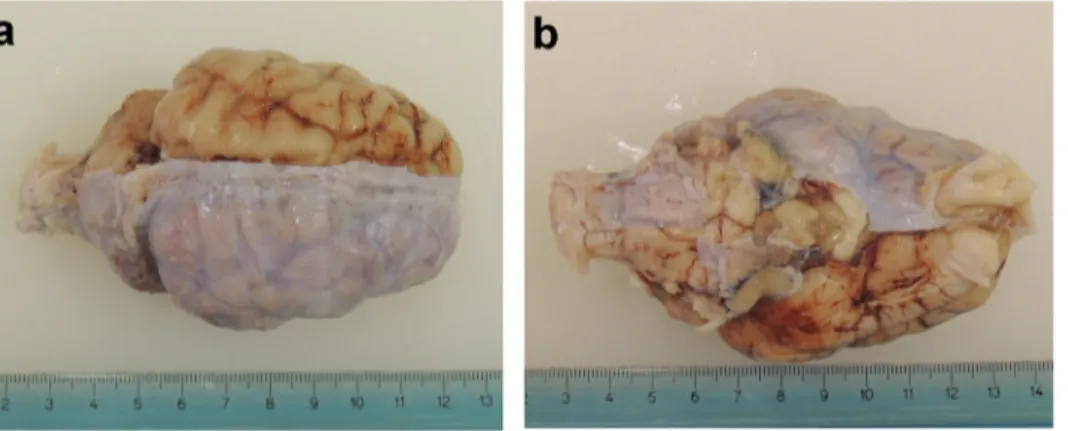 Fig 1. Fixed brain after partial removal of the dura mater. (a) Dorsal view. (b) Ventral view