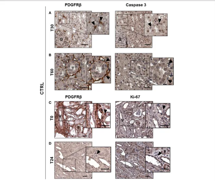 FigUre 3 | Ischemia/reperfusion injury did not induce pericytes apoptosis in vivo. IHC analysis of CTRL group serial sections labeled for PDGFR β and Casp3   (a,b) and for PDGFR β and Ki-67 (c,D)