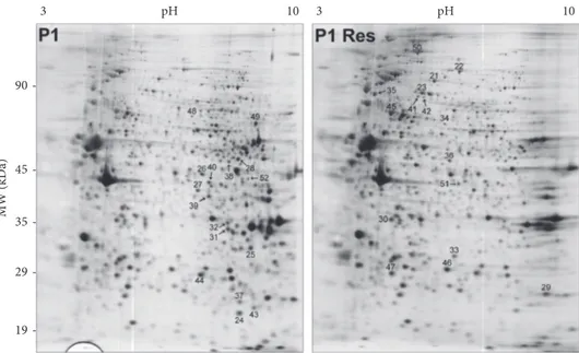 Figure 3: Representative 2-DE gel map of P1 and P1-Res-treated cell proteins. A total of 80 μg of proteins were separated by 2-DE using a 13 cm IPG strip pH 3 –10 NL and 12% SDS-PAGE