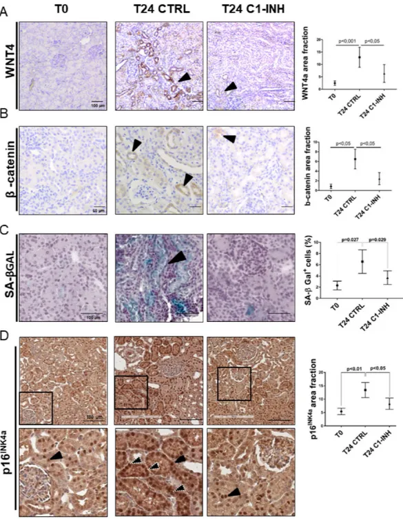 Figure 7. Wnt4/βcatenin pathway and inflammaging markers are activated in tubular cells after I/R and modulated by C1- C1-INH treatment