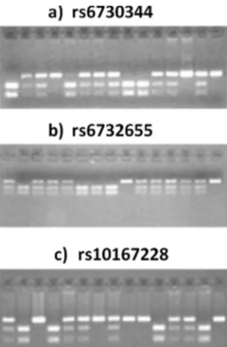 Fig. 4. DNA electrophoretic gels showing patients genotyping for individual polymorphisms.