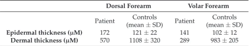 Table 1. Epidermal and dermal thickness of patient’ s forearm evaluated by high-frequency ultrasonography (HF-USG) compared to 10 healthy individuals.