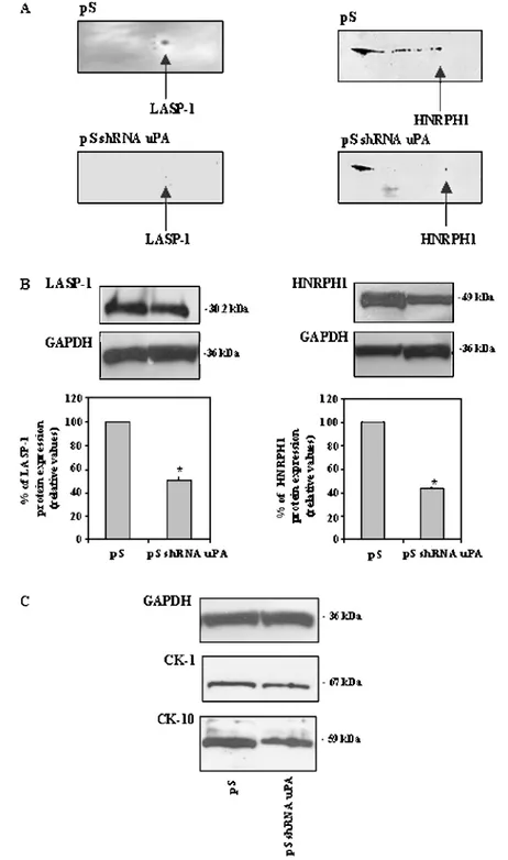 Figure 2. Validation of LASP-1 and HNRPH1 down-modulation by Western blot (WB). Two-dimensional WB (A) and monodimensional WB (B) confirmed the LASP-1 and HNRPH1 protein expression inhibition found by 2D-DIGE experiments in pS shRNA uPA cells