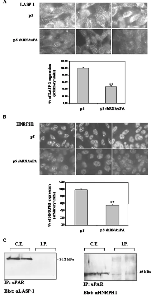 Figure 3. Cellular localization of LASP-1 (A) and HNRPH1 (B) by IF analysis. Panels A and B show the cytoplasmic staining of LASP-1 and the nuclear staining of HNRPH1, respectively