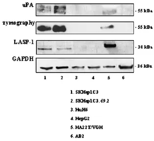 Figure 4. Protein expression analysis of uPA and LASP-1 in human normal and HCC-derived cells