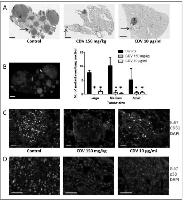 Figure 5: Immunohistochemical analysis of F2T-luc2.9 cell-induced lung metastases. Immunohistochemical analysis was  performed on lung metastases from mice collected 5 weeks after i.v