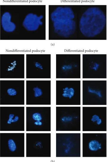 Figure 3: Nuclear expansion and changes in chromatin struc- struc-ture during podocyte differentiation