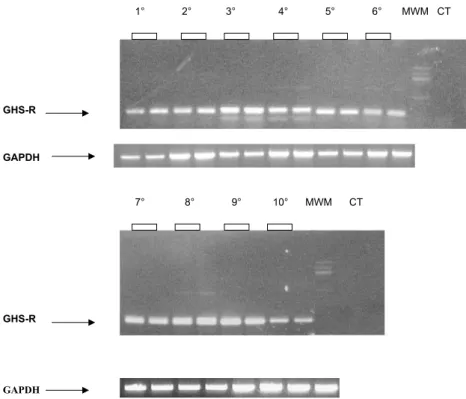 Figure 5 Characterization of GHS receptor protein expression in calvaria cells. The cellular receptor expression was determined by Western blot as described in Materials and Methods
