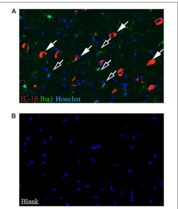 FIGURE 3 | Non-parenchymal macrophages are immunoreactive to MRC1. (A) MRC1 (red) and Iba1 (green) double-labeled cells are localized at CNS interfaces (closed and open arrows) and not in the SN parenchyma (delimited by the dashed line) in 4-month-old c-re
