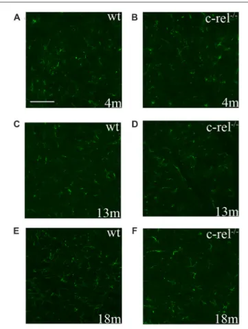 FIGURE 5 | GFAP immunoreactivity in c-rel −/− and wt mice. Pictures of SN
