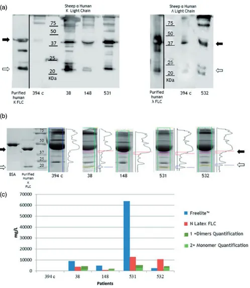 Figure 6. Monomers and dimers analysis. (a) Western blot analysis of 0.2 mg of purified human k FLC or  FLC and 15 mg of serum proteins (patient n