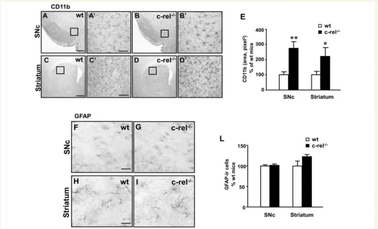 Figure 6 CD11b and GFAP immunoreactivity in 18-month-old c-rel /  and wild-type mice