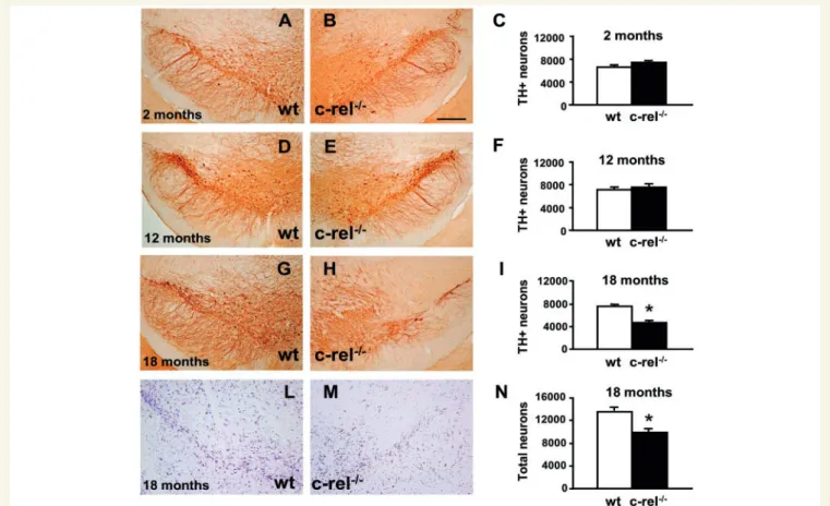 Figure 1 Age-dependent loss of dopaminergic neurons in the substantia nigra of c-rel /  mice