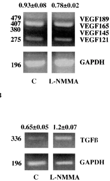Fig. 4. Differential RT-PCR for VEGF isoform (A), and TGF- b1 (B) expression in H.end.FB cells in the presence or in the absence of L -NMMA (1 mM)