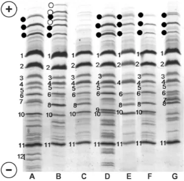 Figure 1. Isoelectrofocusing (IEF) patterns of 7 milk samples (from