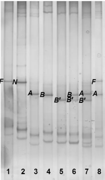Figure 1. Analysis by PCR-single strand conformational polymor-