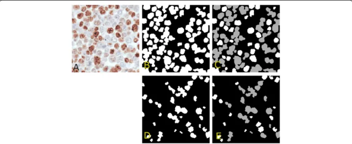 Fig. 2 Nuclei masks. a: sample sub-image. b: positive nuclei mask identifying pixels belonging to positive nuclei