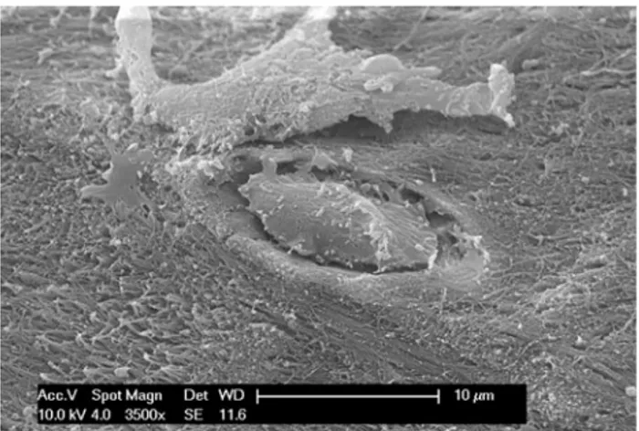 Fig. 5 An osteocyte within its own lacuna has been exposed by osteoclasts in a resorption pit, as evidenced by the tip of the cut collagen fibrils in the lower half of the figure
