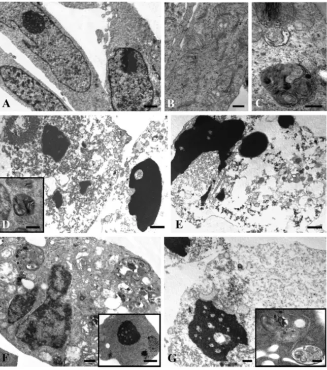 Fig. 2. TEM analysis of control untreated cells (A) versus Mel-treated RH30 cells (in EtOH) (B–G); in detail, representative pictures showing cells treated with 1 mM Mel for 24 h (B, C), 48 h (D, inset D), 72 h (E) and 2 mM Mel for 24–48 h (F, G respective