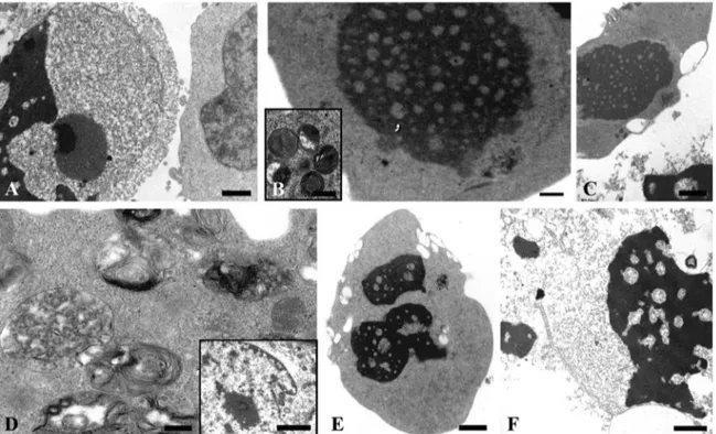 Fig. 3. TEM analysis of Mel–treated RH30 cells (in DMSO) (A–F); in detail, representative pictures showing cells treated with 1 mM Mel for 24–48–72 h (A, B, C respectively) and 2 mM Mel for 24 (D,E) and 48 h (F) Bars: A, C, E, 1 ␮m; B, F, 0.5 ␮m; inset B, 