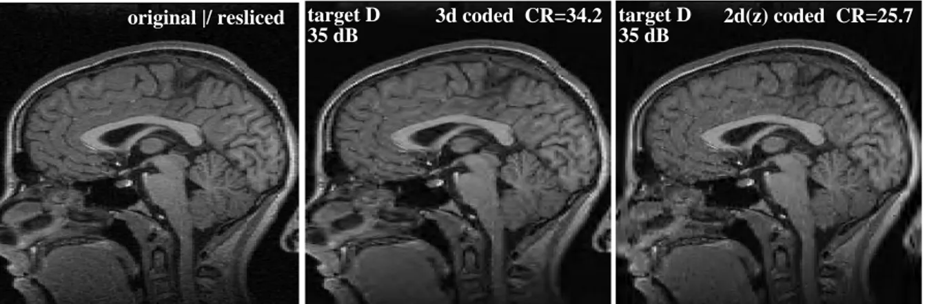 Figure 2: MRI slices originated by a volume reslicing on y . For both the coding modalities a target distortion PSNR