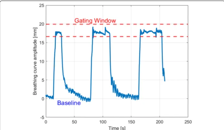 Fig. 2 Time plot showing the vertical breathing curve amplitude over time; dashed red lines are showing the lower and upper limit of the gating window