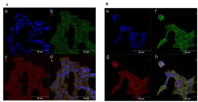 Figure 5. Trabectedin exposure affects the subcellular localization of β-catenin in NCIH295R cells