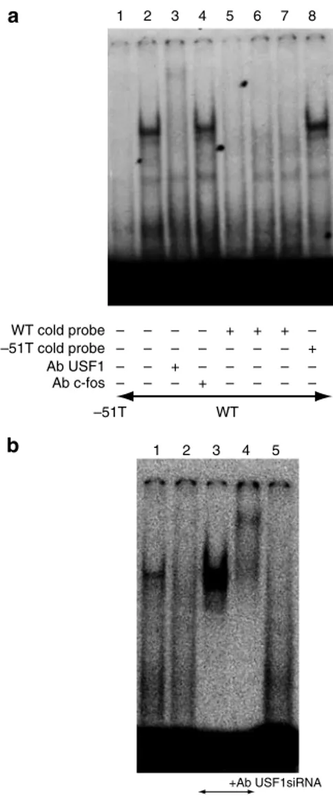 Figure 5 | Characterization of USF1 as the transcriptional factor binding –51G. USF1 RNA silencing produced (a) a 50% expression of USF1 at Western blot and (b) induced in parallel 30% reduction of luciferase expression.