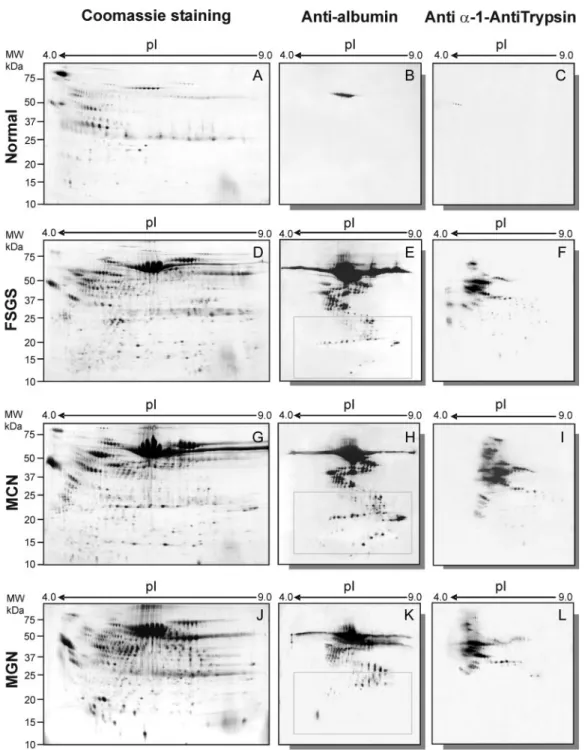 Figure 1. Two-dimensional (2D) electrophoresis and Coomassie staining of a single spot of fresh urine obtained from a normal volunteer