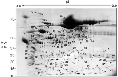 Figure 3. 2D electrophoresis of the sample of urine of Figure 1D,