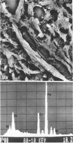 Fig  9 a, b  a Scanning  electron  micrograph  (backscattered  elec-